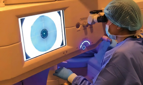 SMILE Eye Surgery