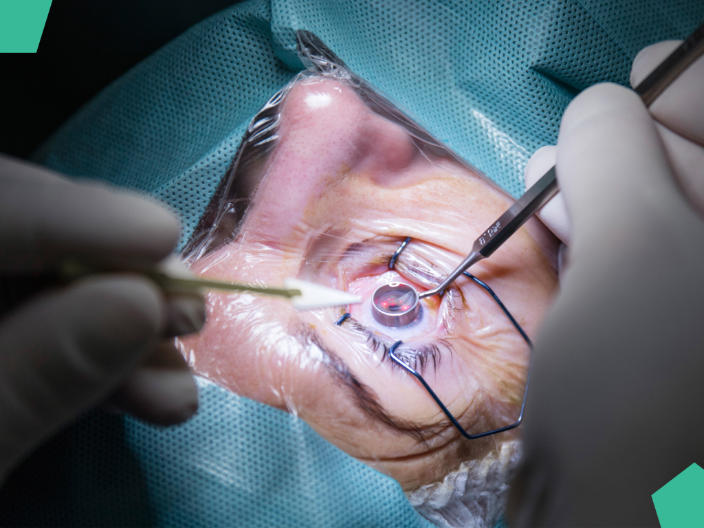 cataract